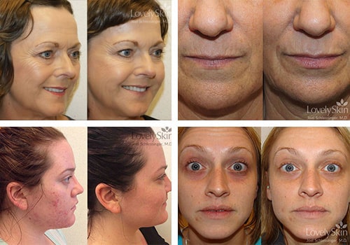 Skin Specialists - Before and After Photos